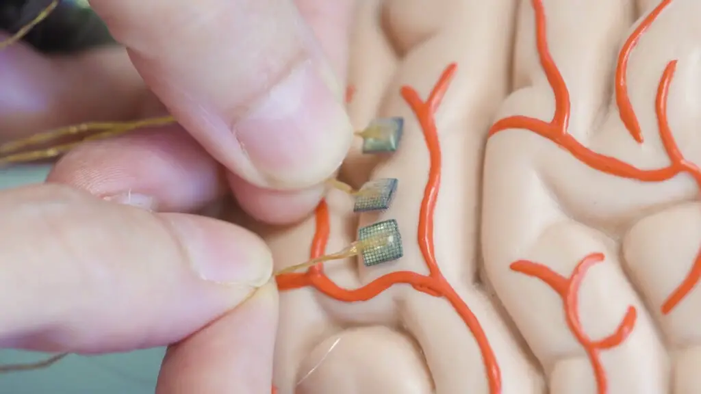 A screenshot from The Wall Street Journal's 2022 YouTube video report 'Inside the Brain Tech Helping Paralyzed Patients Feel Again | Sense Makers.' A hand is demonstrating the placement of electrode arrays on a model brain.